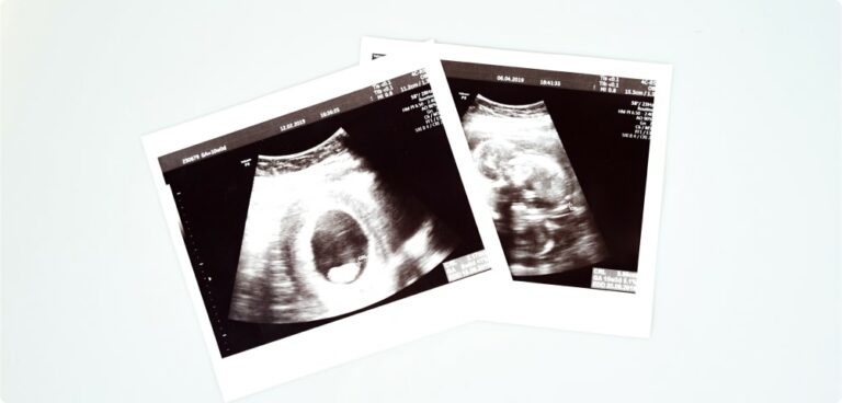 » Ultrasound AI Aims to Save Infants with AI-powered Detection Software