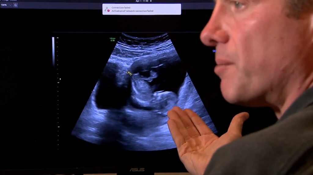 Our Founder Robert Bunn Shares the Story Behind Delivery Date AI™ with CBS News Colorado